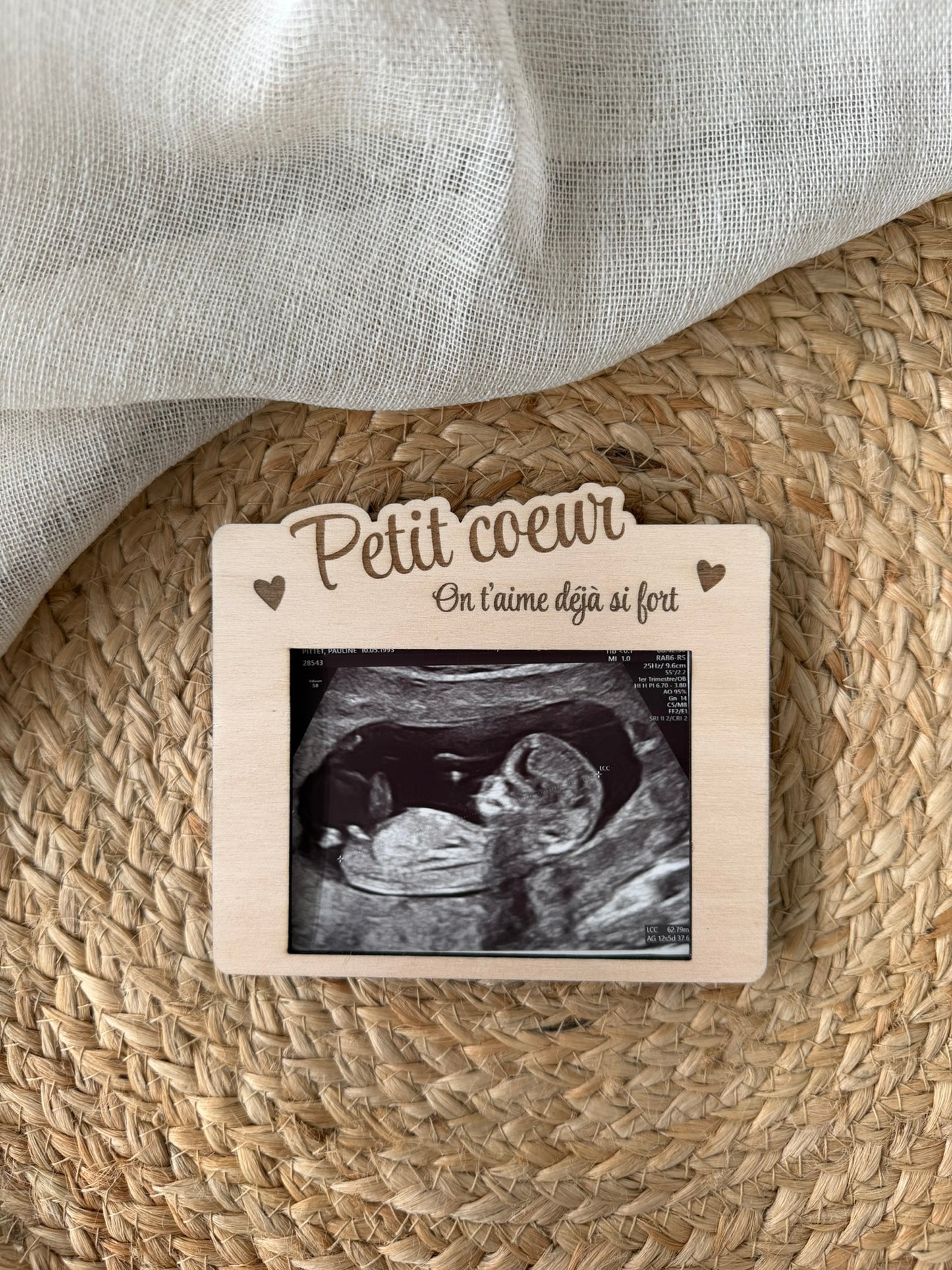 Cadre échographie bébé
